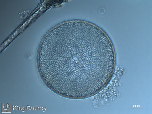 Photo of Coscinodiscus spp.